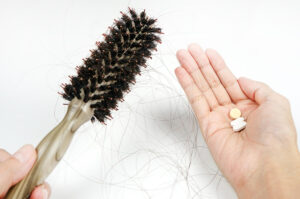 10 reasons for hair loss as to why your hair is falling out